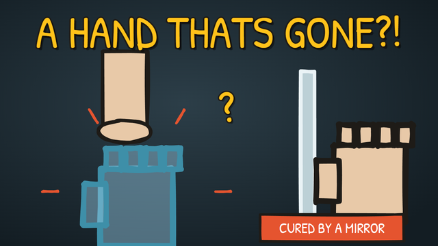 Munchrd: Why do amputees feel a limb that's gone?