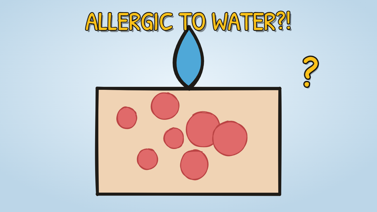 Munchrd illustration for: Why are a few people genuinely allergic to water?